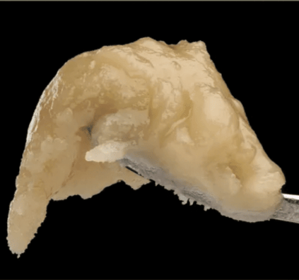 POZM - Live Rosin 1G - Mountain Man Melts - POZM Live Rosin (H) - $42 - Concentrates